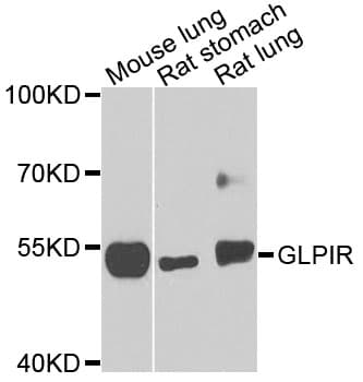 GLP1R / GLP-1 Receptor Antibody