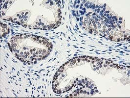 ACY1 / Aminoacylase 1 Antibody (clone OTI1D4)