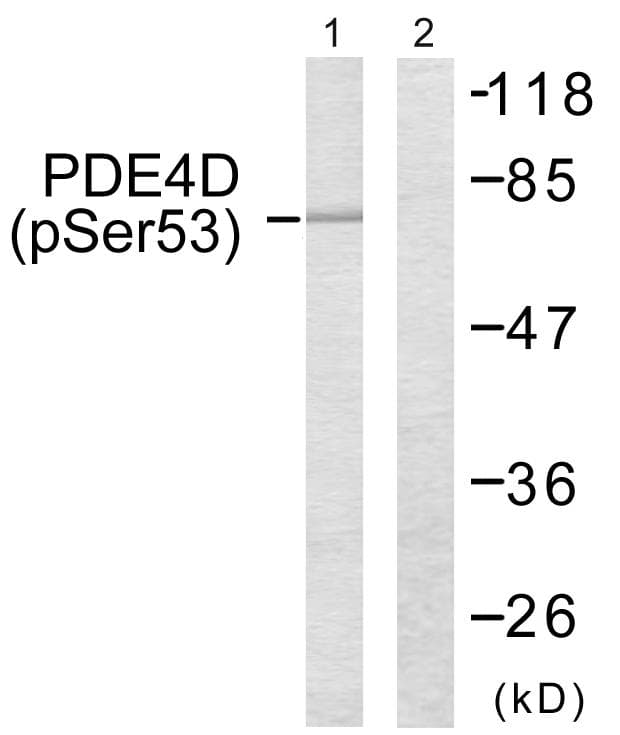 Polyclonal Rabbit anti-Human PDE4D Antibody (phospho-Ser190/53, IHC, WB)