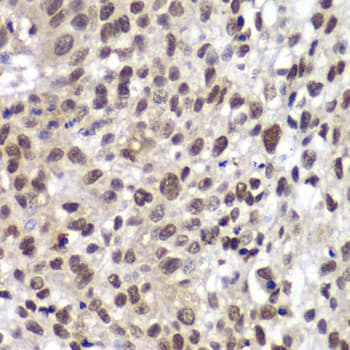 CHEK2 / CHK2 Antibody