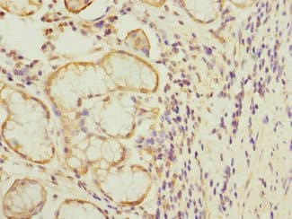MTERF3 / MTERFD1 Antibody