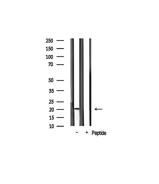 Polyclonal Rabbit anti-Human COX4I2 Antibody (IF, WB)