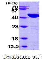 Human Aspartate Aminotransferase Protein (Recombinant His)