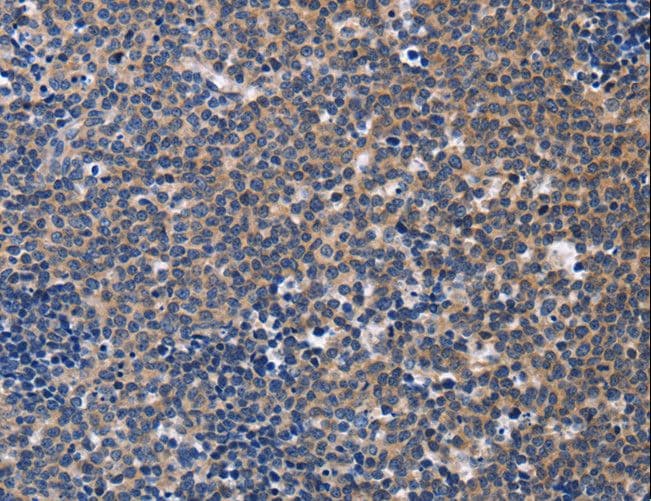 CCR6 Antibody