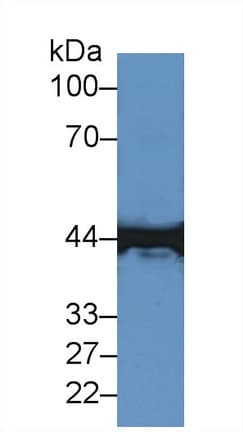 CKM / Creatine Kinase MM Antibody (aa11-367, APC)