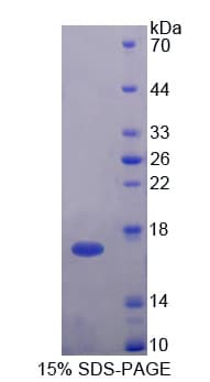 Human H2AFV Protein (Recombinant His-T7)