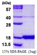 Human IFN Gamma / Interferon Gamma Protein (Recombinant His)