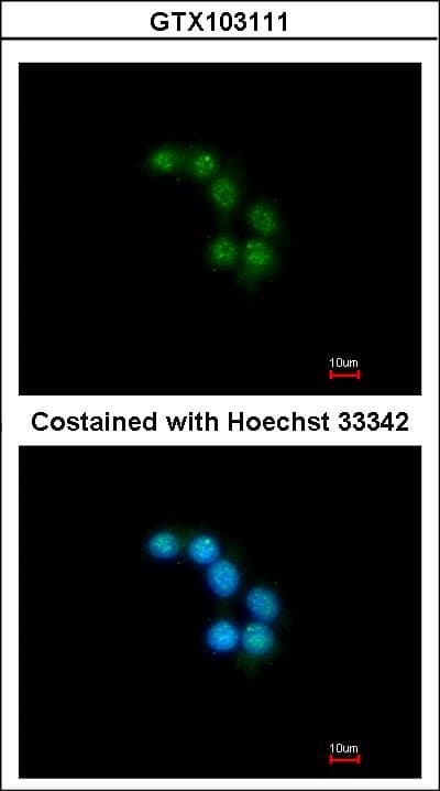 STXBP2 Antibody (aa101-371)