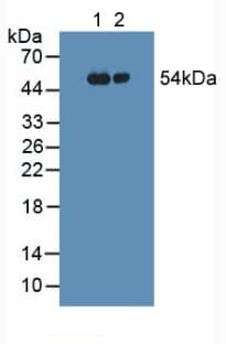 FGG / Fibrinogen Gamma Antibody (aa166-416)