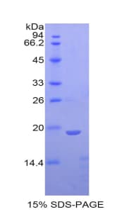 Rat ANGPT1 / Angiopoietin-1 Protein (Recombinant His, N-Terminal)