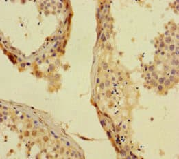 PHC1 / EDR1 Antibody