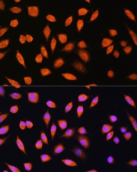 PNPO Antibody