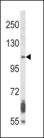FGFR2 / FGF Receptor 2 Antibody