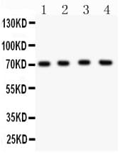 KCND1 / Kv4.1 Antibody (aa442-647)