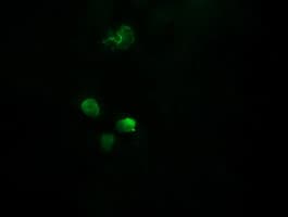 APCS / Serum Amyloid P / SAP Antibody (clone OTI1H2)