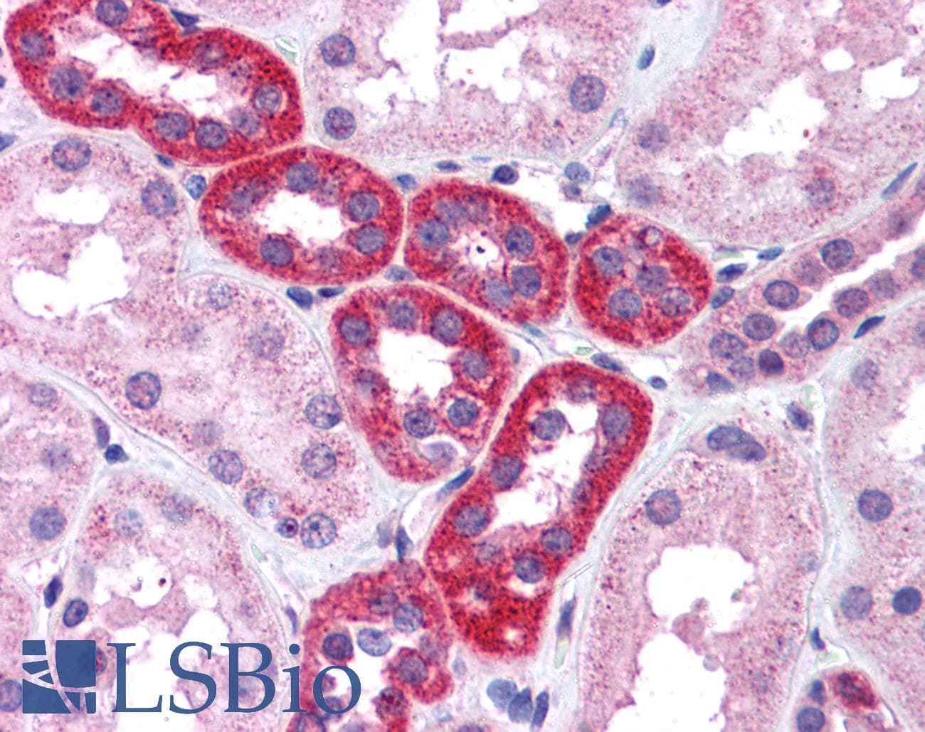 IHC-plus™ Polyclonal Goat anti-Human RPS6KB1 / P70S6K / S6K Antibody (aa490-502, IHC, WB)