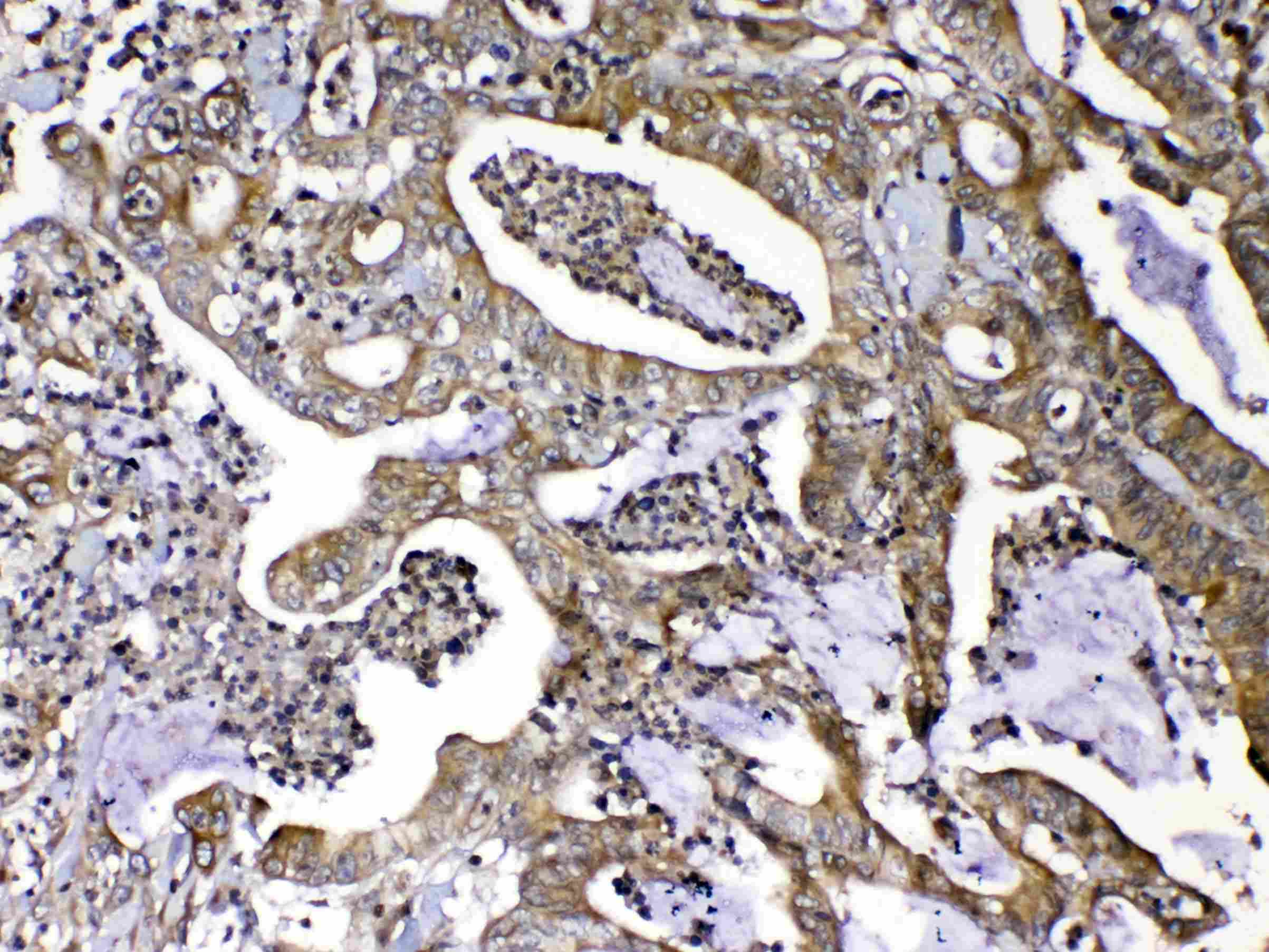 MMP16 Antibody