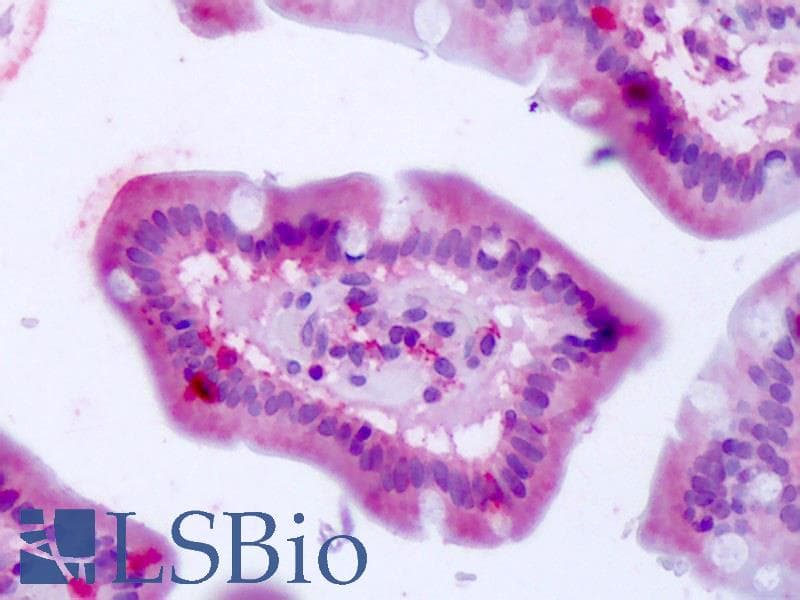 IHC-plus™ Polyclonal Rabbit anti-Human BEST4 Antibody (Internal, IHC)