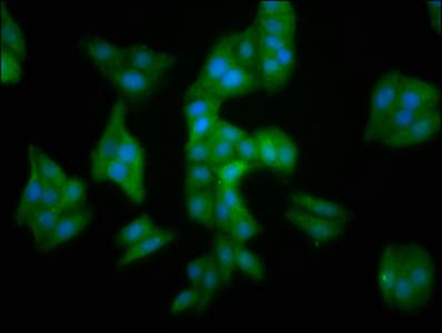 MMADHC / C2orf25 Antibody