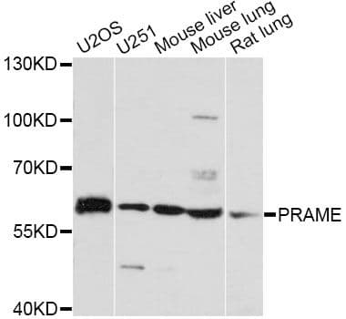 Polyclonal Rabbit anti-Human PRAME Antibody (WB)
