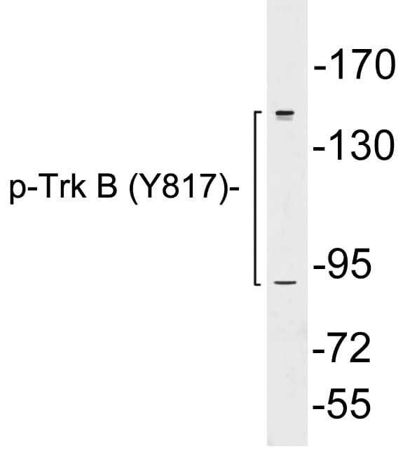 Polyclonal Rabbit anti-Human NTRK2 / TRKB Antibody (phospho-Tyr817, WB)