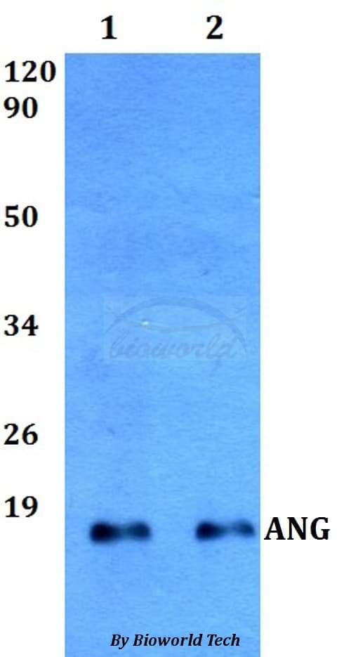 Polyclonal Rabbit anti-Human Angiogenin / ANG Antibody (IHC, WB)