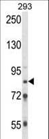 IHC-plus™ TARSL2 Antibody (aa638-665)