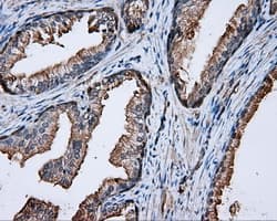 PRKAR2A Antibody (clone OTI1G7)