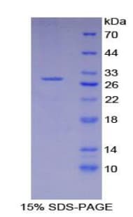 Mouse XRCC6 / Ku70 Protein (Recombinant His-T7)