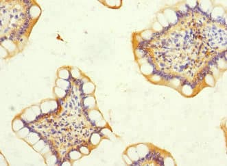 Polyclonal Rabbit anti-Human DSC2 / Desmocollin 2 Antibody (IHC)