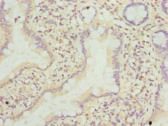 Polyclonal Rabbit anti-Human TMEM243 Antibody (IHC)