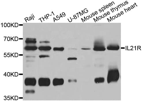 IL21 Receptor Antibody