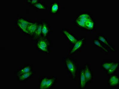 Polyclonal Rabbit anti-Human FACL2 / ACSL1 Antibody (IF)
