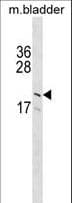 GP9 / CD42a Antibody (aa106-134)