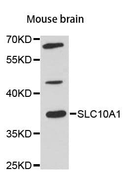 Polyclonal Rabbit anti-Human SLC10A1 / NTCP Antibody (WB)