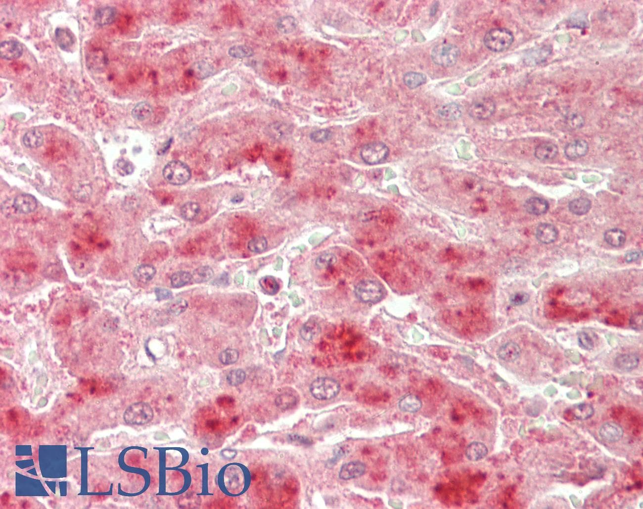 IHC-plus™ Polyclonal Goat anti-Human NAK / TBK1 Antibody (aa514-527, IHC, WB)