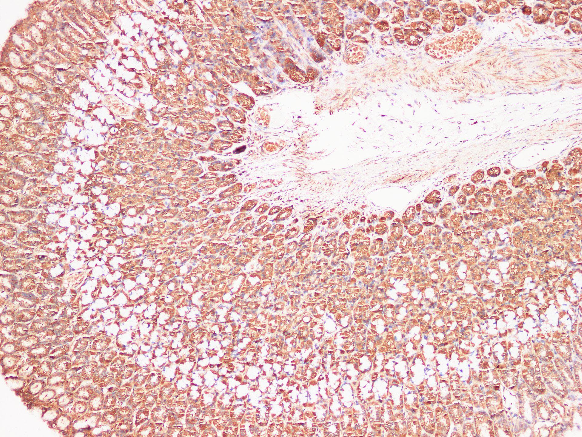 Polyclonal Rabbit anti-Rat S100A9 / MRP14 Antibody (IHC, WB)