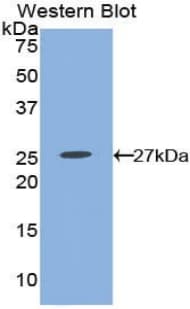 PTGER2 / EP2 Antibody (aa155-355, Biotin)