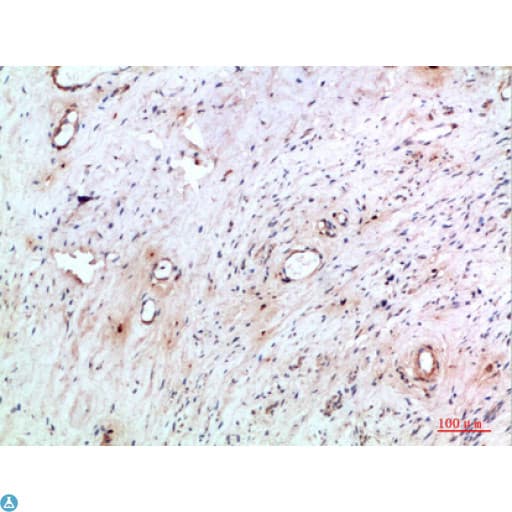 Polyclonal Rabbit anti-Human TNIP2 / ABIN-2 Antibody (IHC)