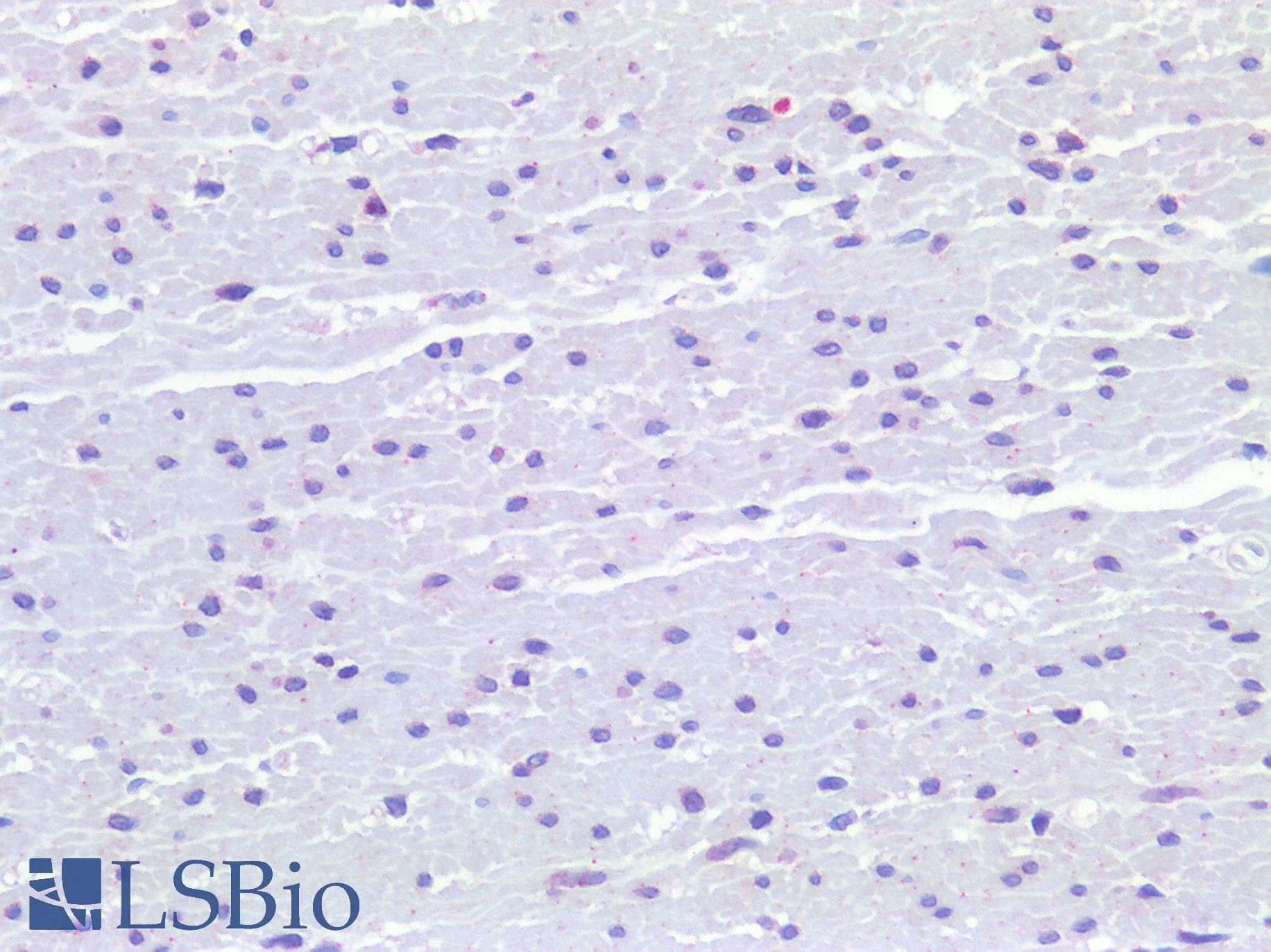 IHC-plus™ FPR1 / FPR Antibody (aa155-204)