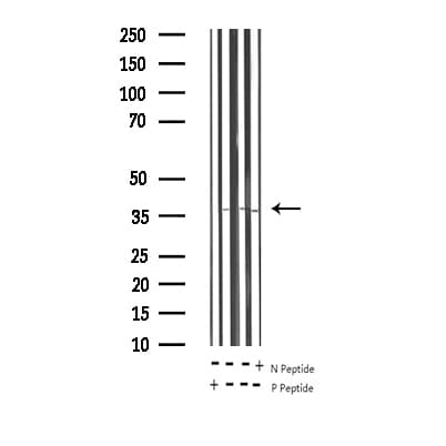 RPA2 / RFA2 / RPA34 Antibody (phospho-Thr21)