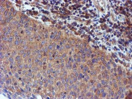 IDS / Iduronate 2 Sulfatase Antibody (clone OTI4G2)