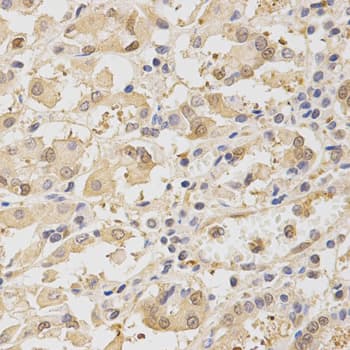 TOLLIP Antibody