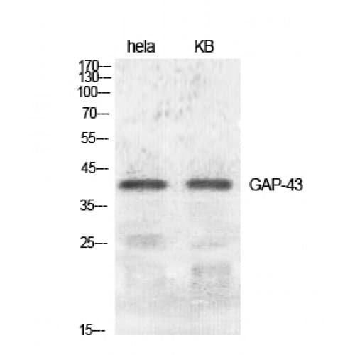 GAP43 Antibody (20-100 aa)