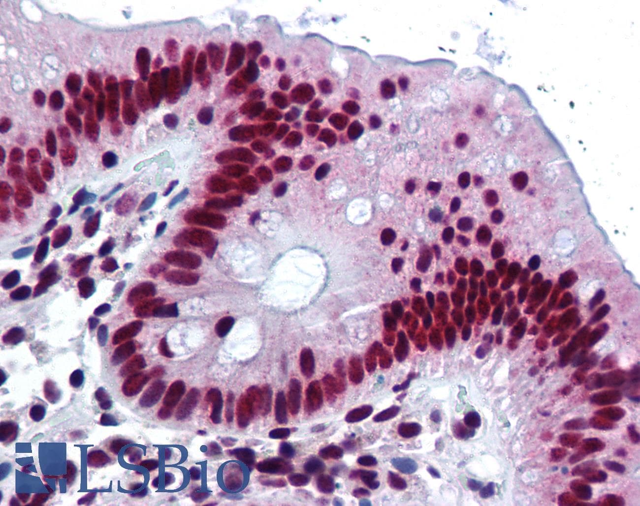 IHC-plus™ HNRNPK / hnRNP K Antibody (clone F45 P9 C7)