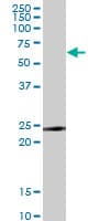 IHC-plus™ Monoclonal Mouse anti-Human TNFRSF18 / GITR Antibody (clone 2H4, IHC, WB)