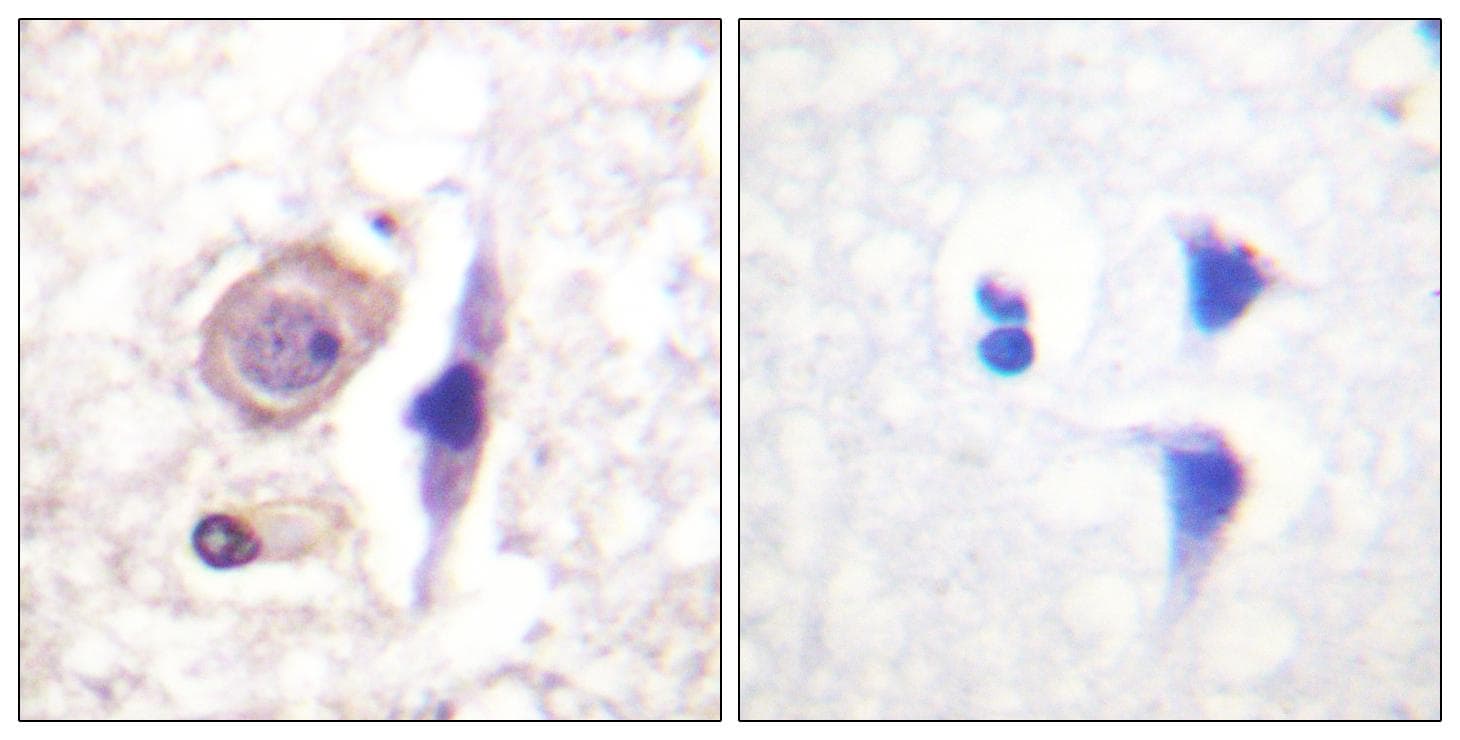 CD119 / IFNGR1 Antibody (p457)