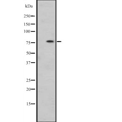 Polyclonal Rabbit anti-Human HSPA12B Antibody (WB)