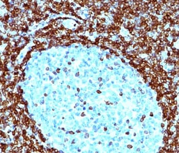 BCL2 / Bcl-2 Antibody (aa41-54, clone 124, Ready-to-Use)