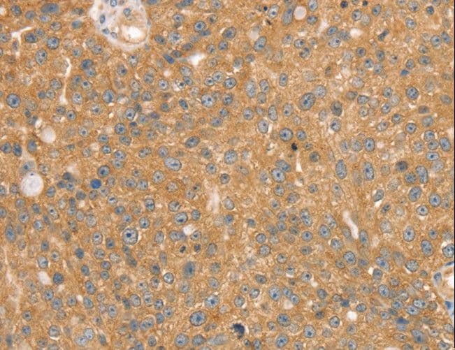 SNX2 Antibody